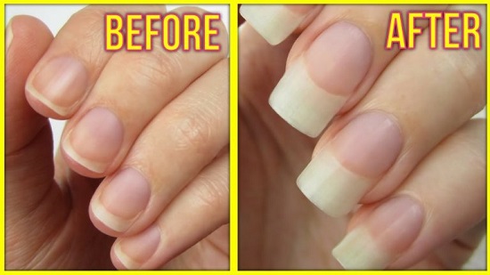 DIY Nail Growth Serum Recipes1