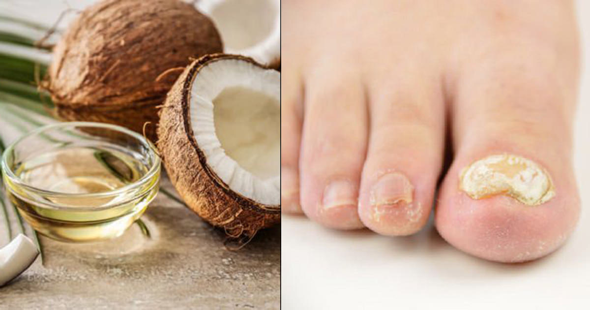 2. The Benefits of Using Coconut Oil for Nail Art - wide 3