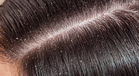 Ungurahua Oil Benefits for Hair3